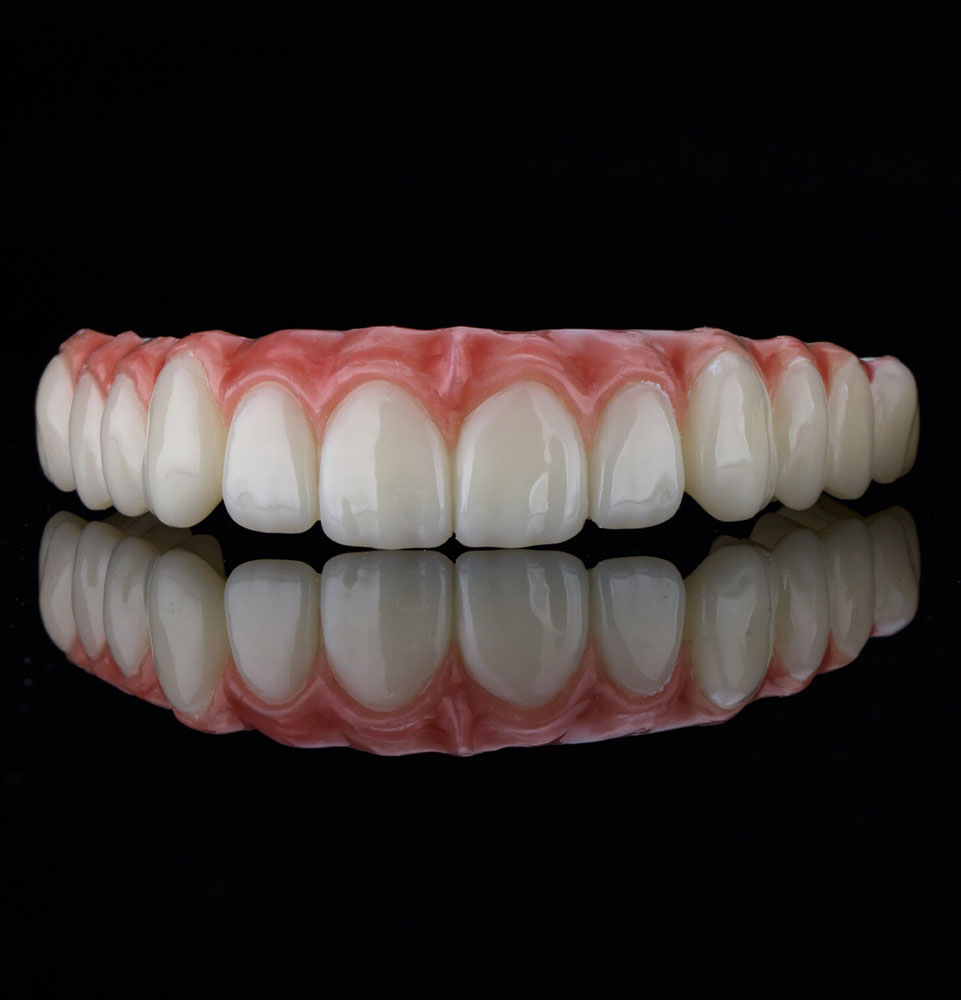 full arch real on table